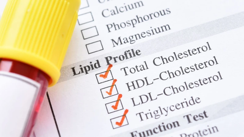 Các chỉ số thường được đánh giá gồm cholesterol toàn phần, cholesterol LDL, cholesterol HDL và triglyceride