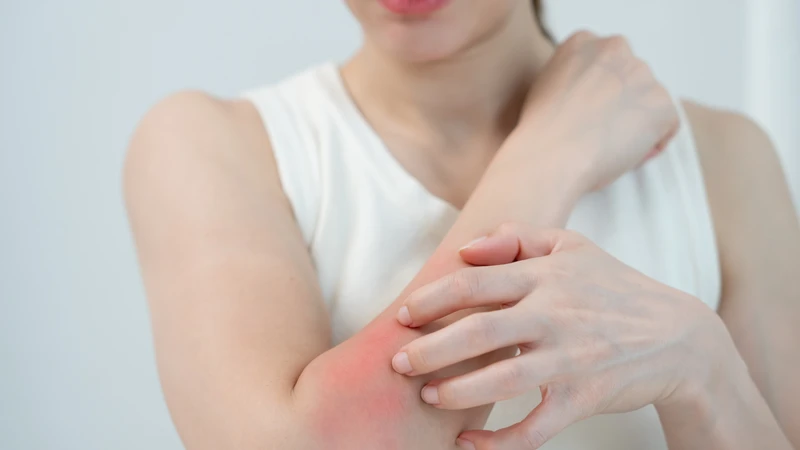 Cần tìm đúng nguyên nhân để xử lý tình trạng ngứa kéo dài