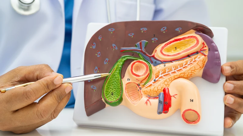 Nhưng người có tiền sử sỏi mật hoặc viêm túi mật cần thận trọng khi sử dụng tinh bột nghệ