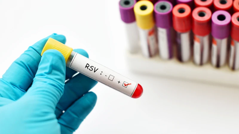 RSV có thể ảnh hưởng nghiêm trọng đến sức khỏe hô hấp của trẻ nhỏ