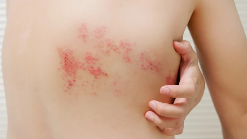 Theo dõi sau tiêm giúp phát hiện sớm phản ứng bất thường