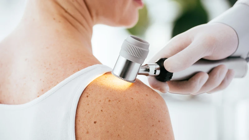 Vắc xin Enteromix đang được thử nghiệm lâm sàng cho bệnh nhân u hắc tố