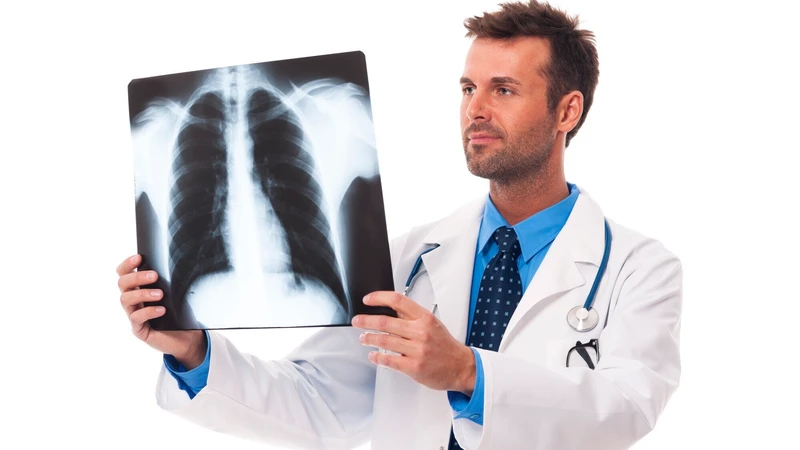 Vai trò, ý nghĩa và quy trình chụp X quang viêm phổi 3