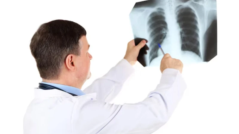 Vai trò, ý nghĩa và quy trình chụp X quang viêm phổi 4