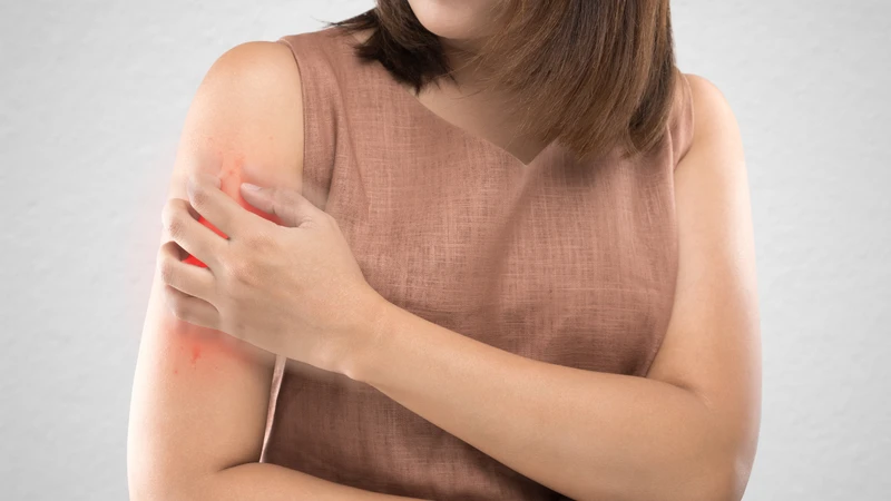 Bệnh vảy nến không phải là bệnh lây truyền