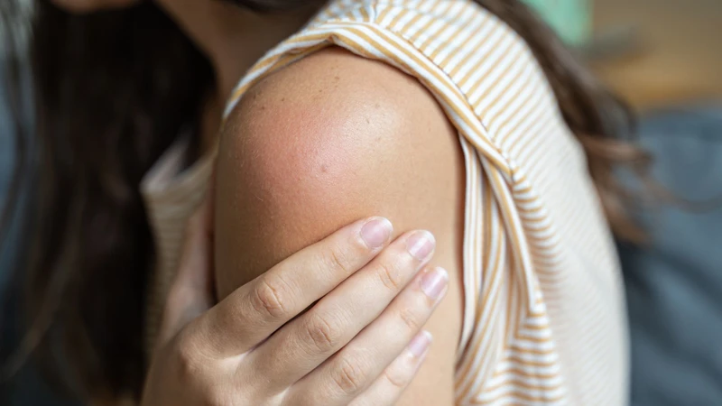 Vết tiêm phế cầu bị sưng: Nguyên nhân, cách xử trí và phòng ngừa 1