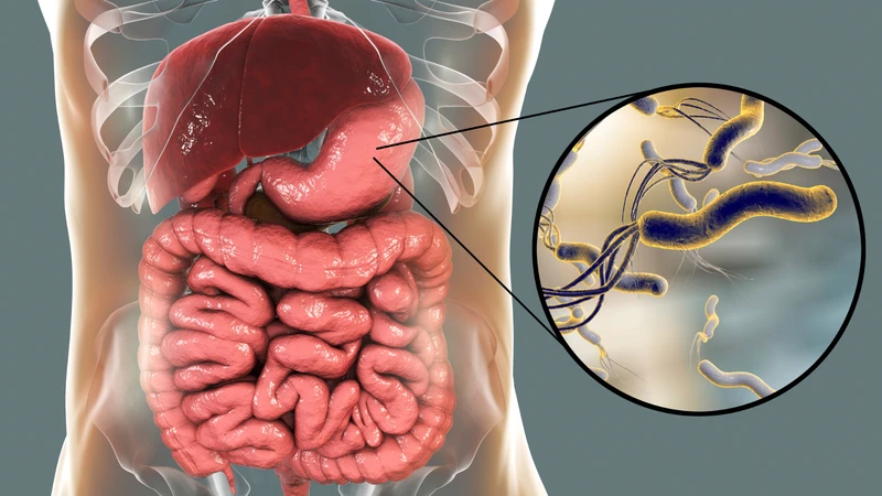 Vi khuẩn HP có nguy hiểm không? Cách điều trị diệt vi khuẩn HP 1