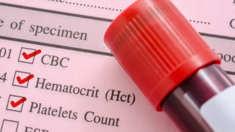 Xét nghiệm HCT trong sốt xuất huyết giúp phát hiện tình trạng cô đặc máu do thoát huyết tương