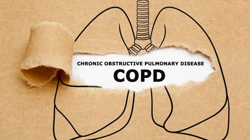 Người mắc bệnh phổi tắc nghẽn mạn tính (COPD) có thể diễn tiến nặng nếu nhiễm virus hợp bào hô hấp (RSV)
