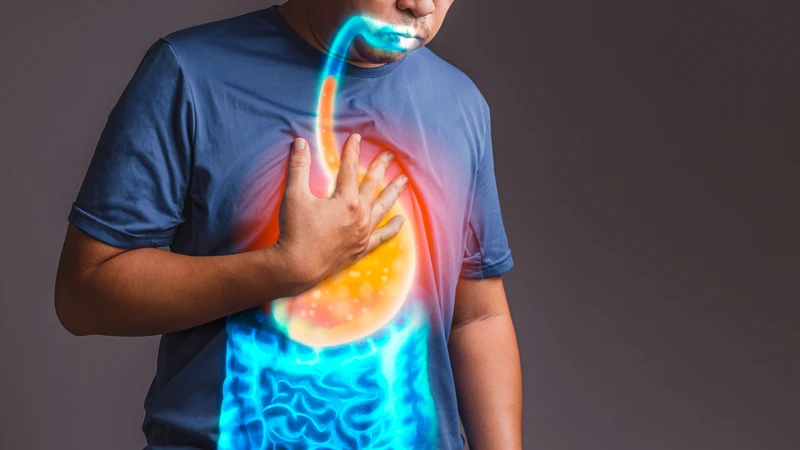 Trào ngược dạ dày không được kiểm soát có thể dẫn đến các biến chứng nghiêm trọng