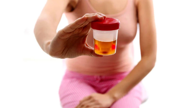 Viêm bàng quang là gì? Những điều cần biết 1.jpg
