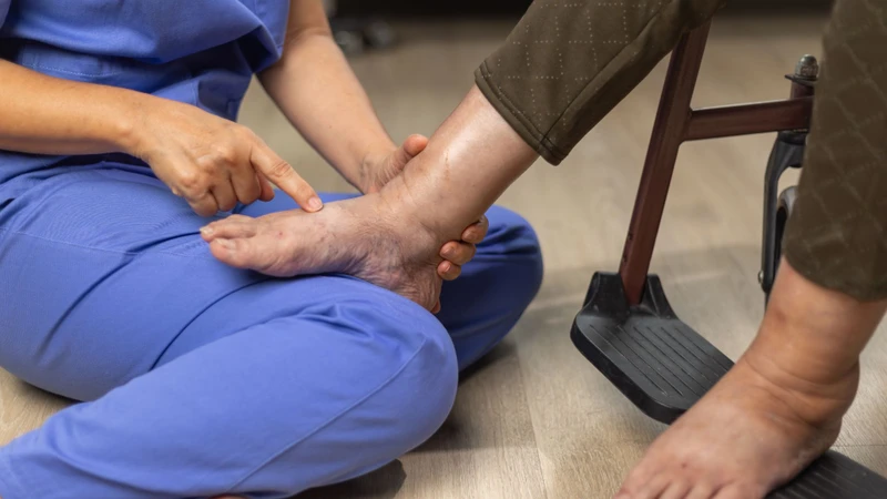 Phù chân và tăng cân nhanh có thể là dấu hiệu cơ thể đang giữ nước