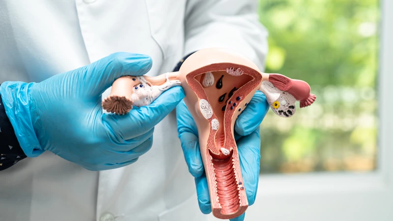 Viêm cổ tử cung có chữa khỏi được không? Lời giải đáp chi tiết từ chuyên gia y tế1