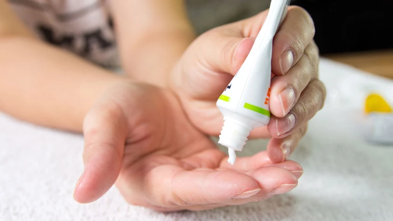 Corticosteroid dạng bôi giúp làm dịu phản ứng viêm, giảm sưng đỏ và ngứa