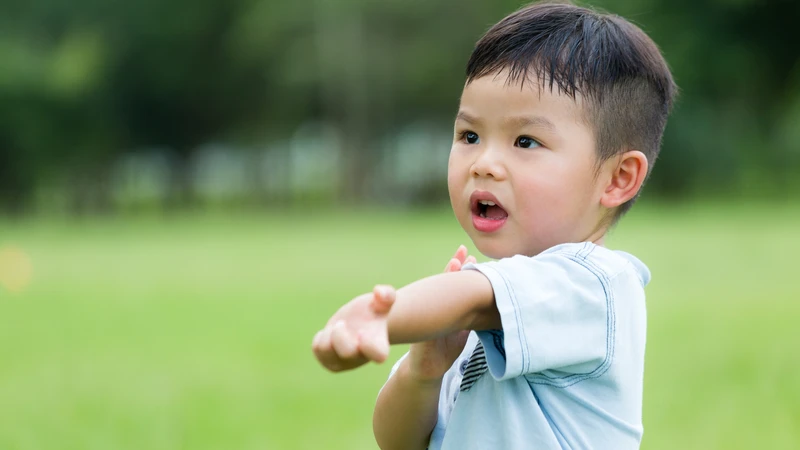 Viêm da dị ứng ở trẻ em 3