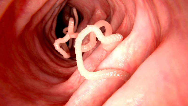 Người bị viêm gan B uống thuốc tẩy giun được không?