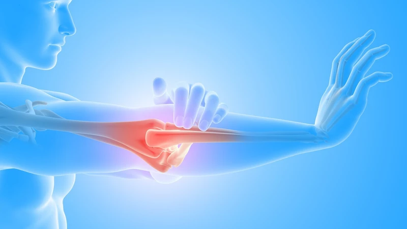 Viêm khớp dạng thấp đặc trưng bởi tình trạng hệ miễn dịch tấn công nhầm vào các mô khớp, gây viêm, sưng và&nbsp;đau khớp