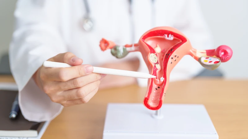 Không điều trị kịp thời có thể dẫn đến biến chứng nguy hiểm, trong đó có ung thư cổ tử cung