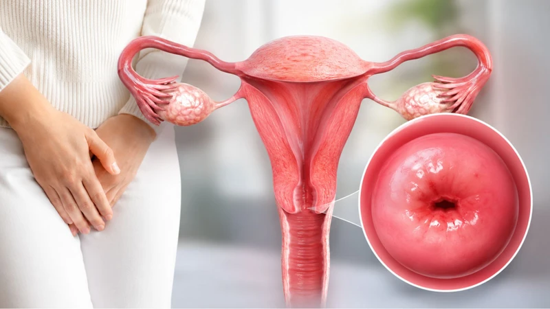 Viêm lộ tuyến cổ tử cung có lây không? được nhiều người quan tâm