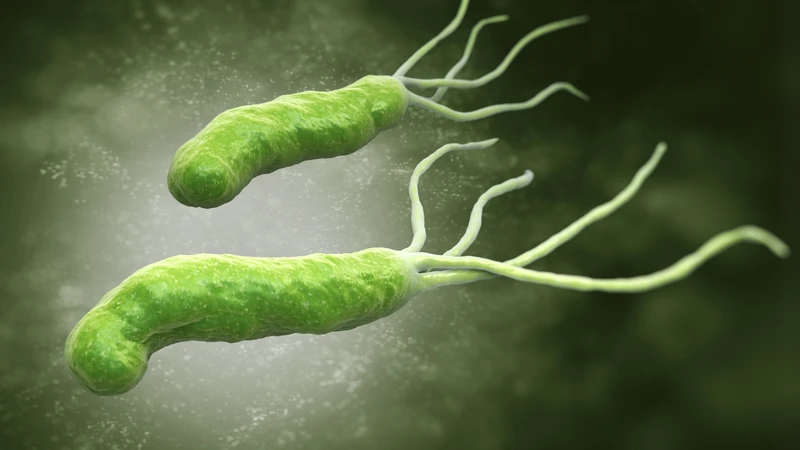 Nhiễm khuẩn Helicobacter pylori (H. pylori) gây viêm loét bờ cong nhỏ dạ dày