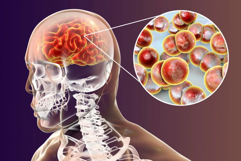 Viêm não mô cầu BC tiêm mấy mũi là đủ? 2