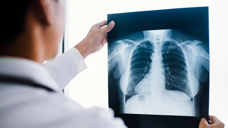 Viêm phổi do Klebsiella pneumoniae có nguy hiểm không? 3