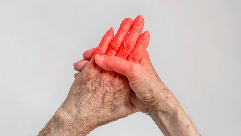 Viêm phổi kẽ không đặc hiệu: Triệu chứng, nguyên nhân và phương pháp điều trị 4