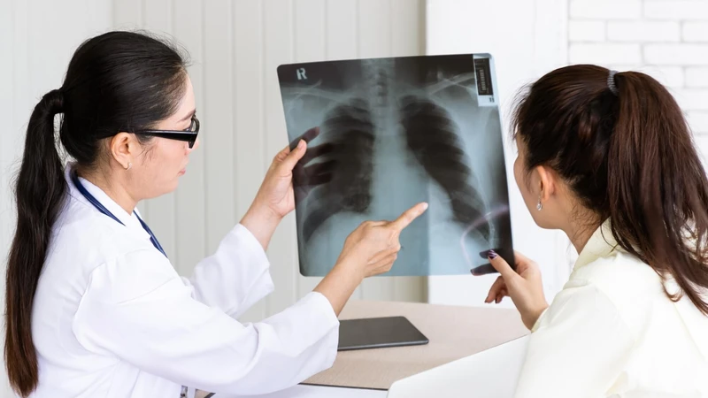 Viêm phổi kẽ sống được mấy năm? Hiểu đúng để sống chung với bệnh hiệu quả 1