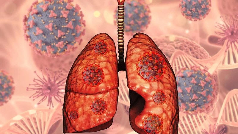 viem-phoi-mycoplasma-nguyen-nhan-trieu-chung-va-bien-phap-phong-ngua 1.png