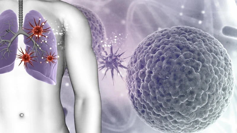 viem-phoi-mycoplasma-nguyen-nhan-trieu-chung-va-bien-phap-phong-ngua 3.png