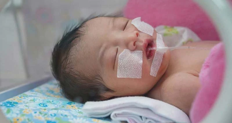 Viêm tai giữa ở trẻ sơ sinh có thể gây ra biến chứng nội sọ nguy hiểm, cần điều trị kịp thời
