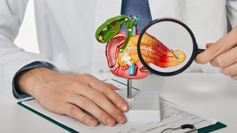 Viêm tụy cấp có chữa khỏi được không? Có thể được điều trị khỏi nếu phát hiện sớm và tuân thủ đúng phác đồ của bác sĩ