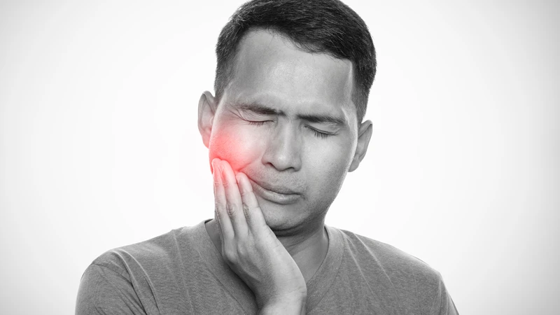 Viêm tủy răng có mủ là bệnh gì?