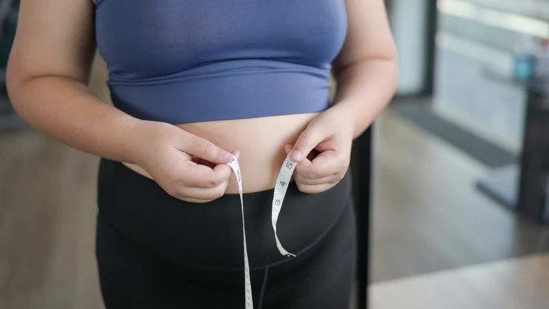 Thừa cân, béo phì là nguyên nhân làm tăng nguy cơ và mức độ nghiêm trọng của viêm tuyến mồ hôi mủ