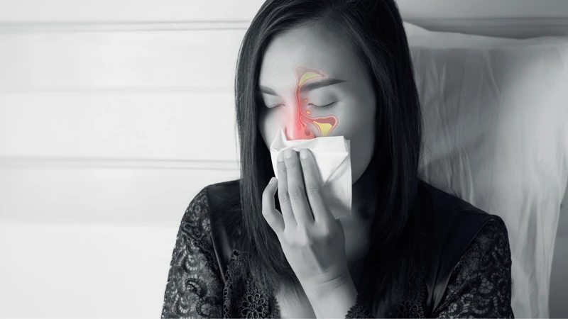 Viêm xoang gây ho kéo dài: Nguyên nhân, cách điều trị và biện pháp phòng bệnh 2