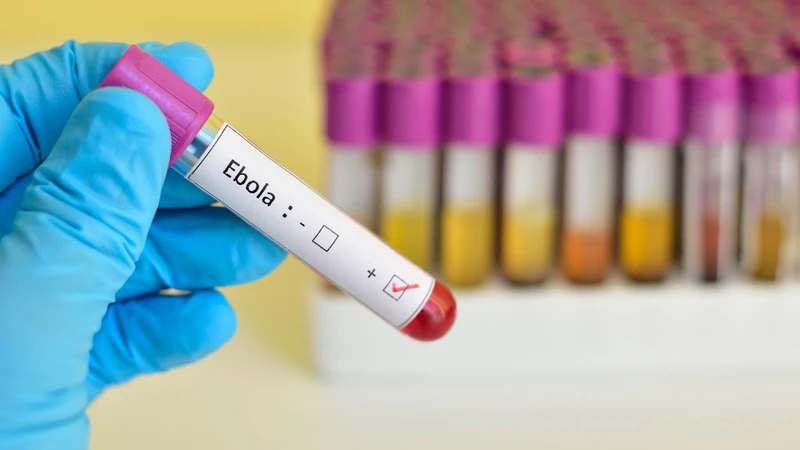 virus-ebola-rung-tai-la-gi-nguon-goc-va-trieu-chung4.jpg