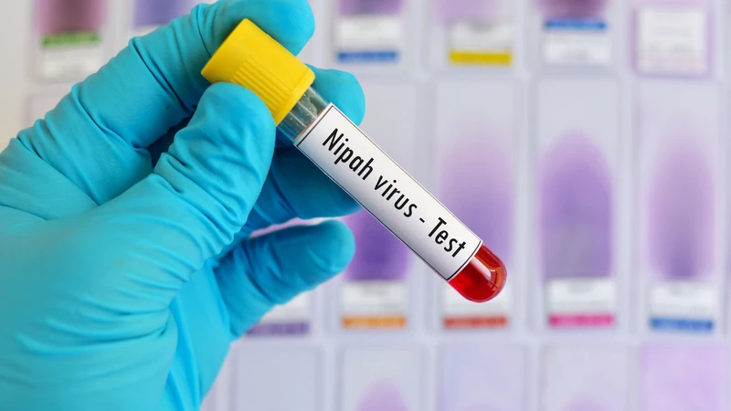 Virus Nipah đã xuất hiện tại bang Tây Bengal, nơi đã ghi nhận 5 ca nhiễm, bao gồm cả bác sĩ và điều dưỡng