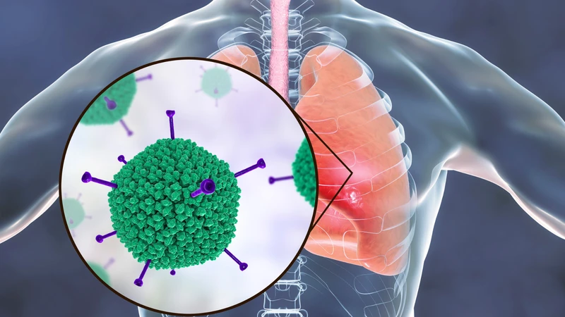 Virus quai bị sống trong không khí bao lâu?