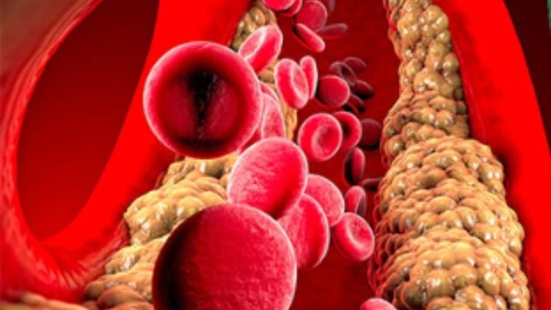 VLDL vận chuyển triglyceride đi khắp cơ thể để cung cấp năng lượng