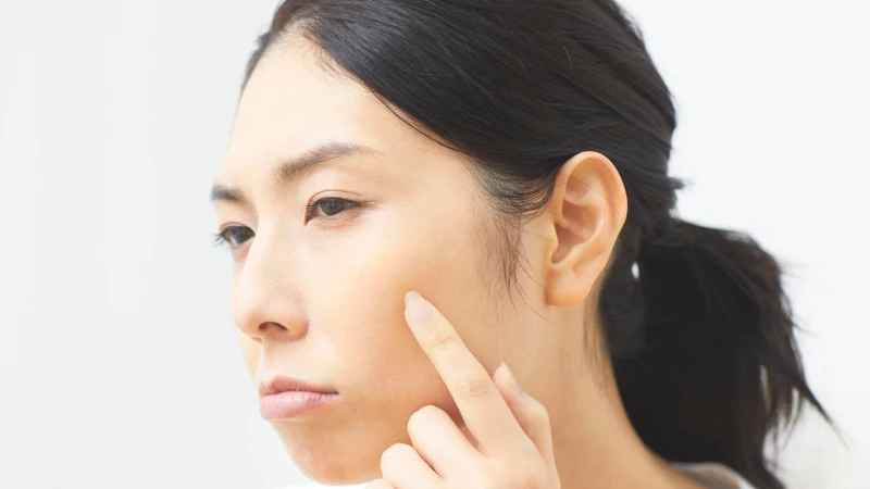 Da khô là một trong những nguyên nhân phổ biến gây kích ứng vùng mắt