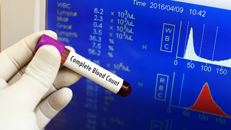 Một chỉ số WBC bất thường không phải lúc nào cũng đồng nghĩa với bệnh lý nghiêm trọng