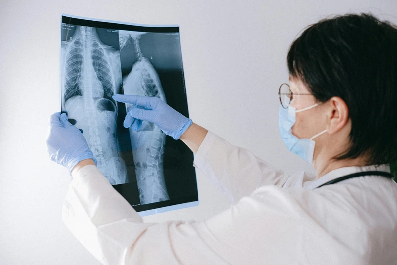 X-quang bụng là gì? Quy trình thực hiện và trường hợp chống chỉ định 3