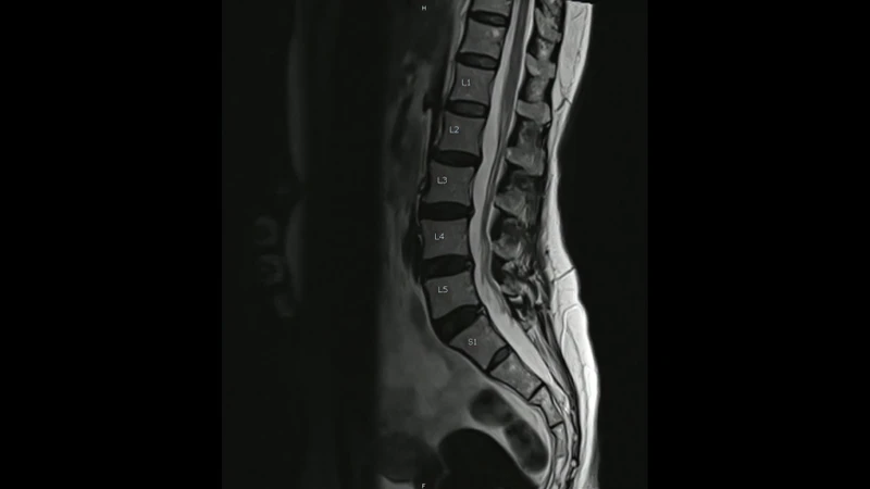 Chụp X-quang có chi phí thấp so với các phương pháp khác như MRI và CT