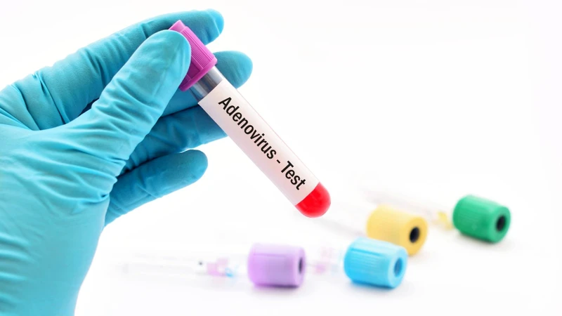 Xét nghiệm adenovirus giúp phát hiện virus gây bệnh