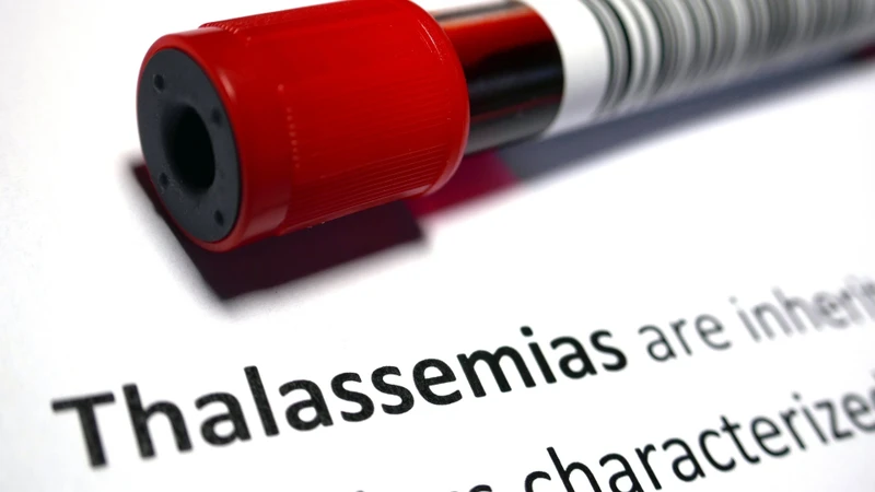 Xét nghiệm ADN có thể giúp phát hiện các đột biến gen liên quan đến bệnh Thalassemia