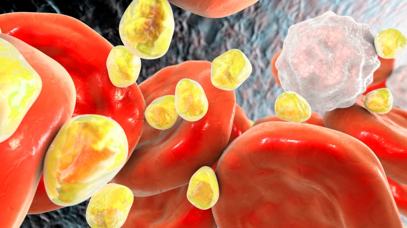 Bác sĩ sẽ cân nhắc thực hiện xét nghiệm ApoA-I ở người có chỉ số lipid máu bất thường