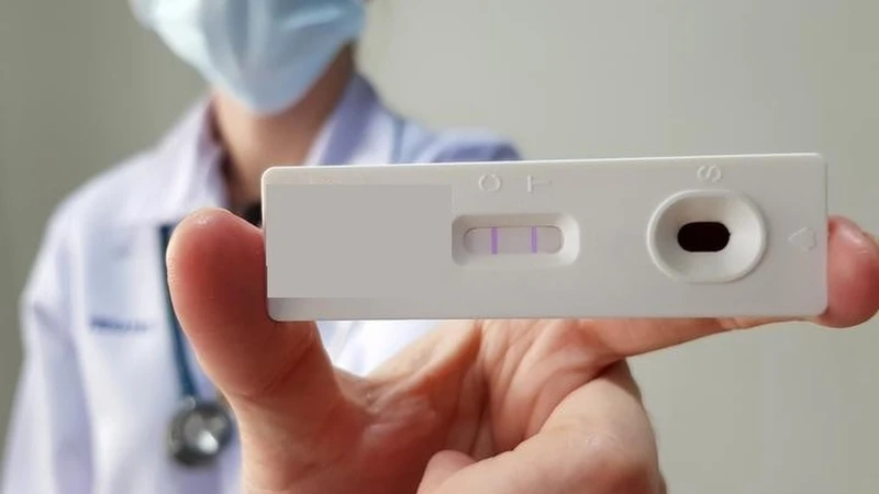 Xét nghiệm chẩn đoán cúm nhanh gồm những phương pháp nào? 2