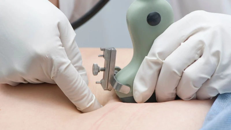 Xét nghiệm chọc ối hết bao nhiêu tiền
