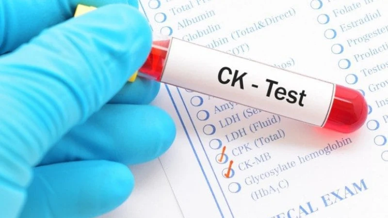 Xét nghiệm CK-MB giúp đánh giá tổn thương cơ tim, đặc biệt trong chẩn đoán nhồi máu cơ tim