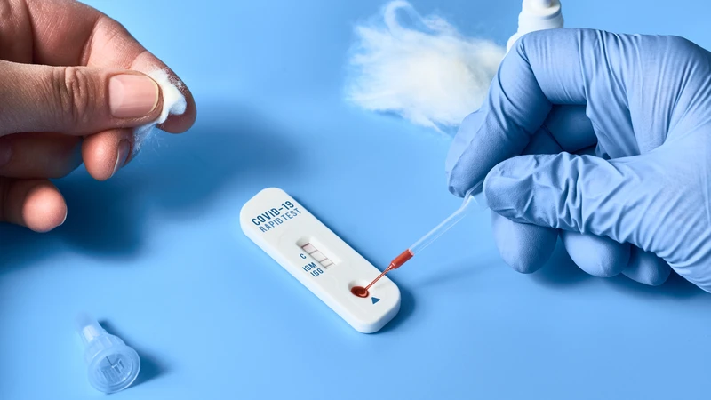 Xét nghiệm Covid bao nhiêu tiền? Các phương pháp xét nghiệm hiện nay 1